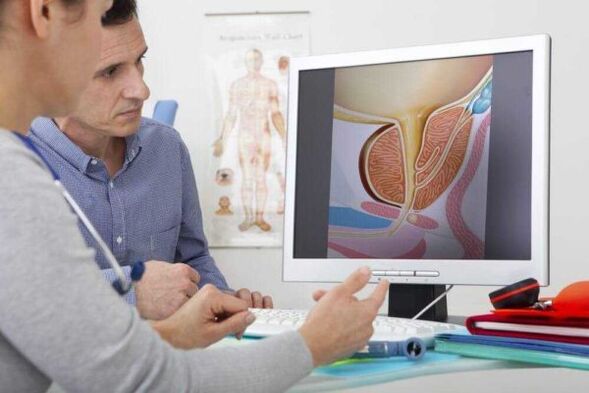 kumunsulta ang doktor sa pasyente sa isyu ng prostatitis