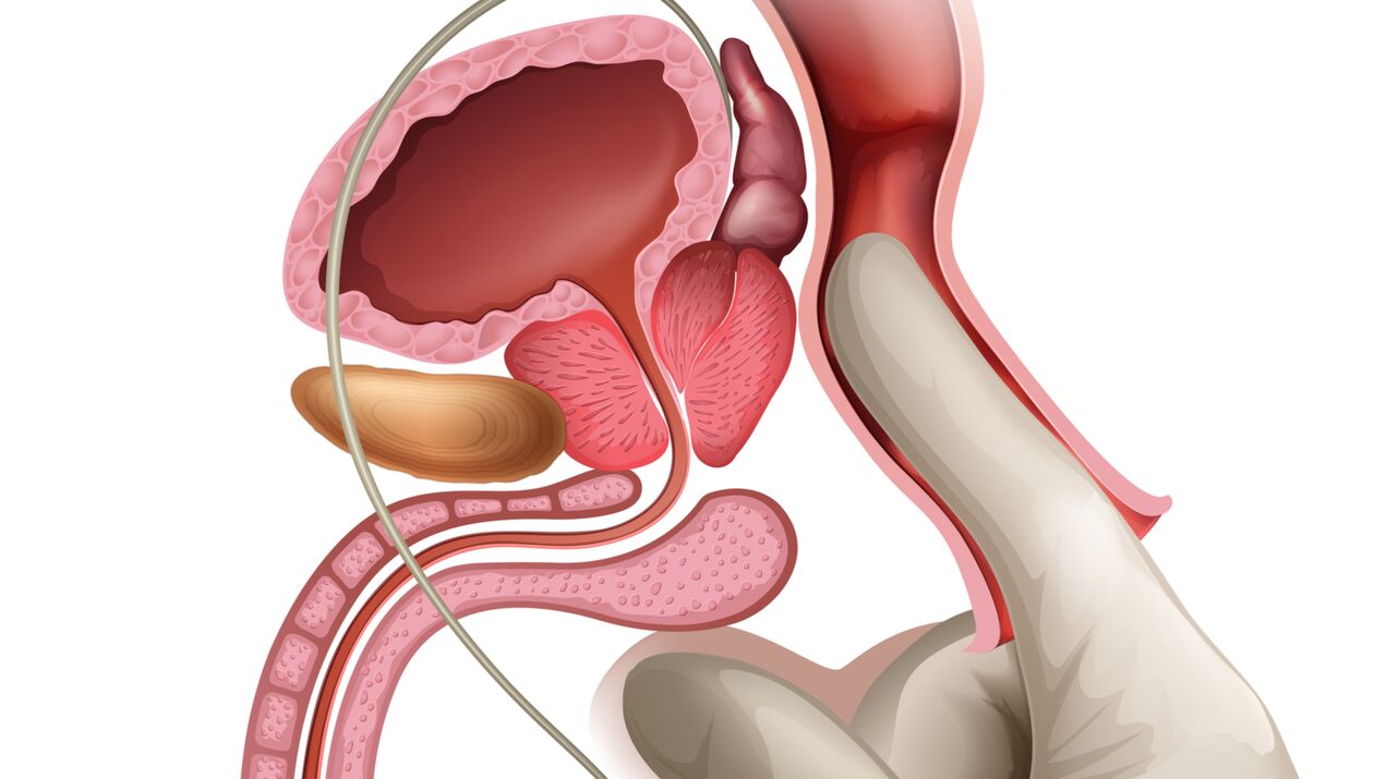 Ang prostate massage ay isang mabisang paraan upang gamutin ang congestive prostatitis