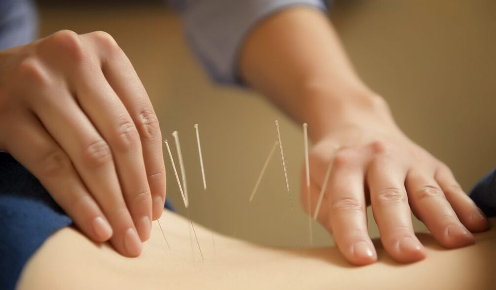 Ang acupuncture ay isang karaniwang paraan ng paggamot sa talamak na prostatitis